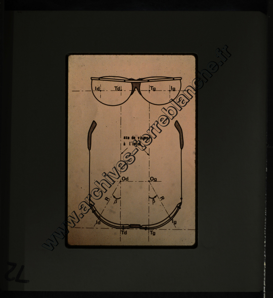 La Protection de la vue