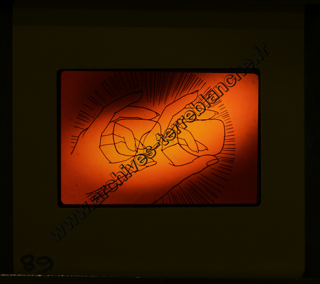 La Protection de la vue