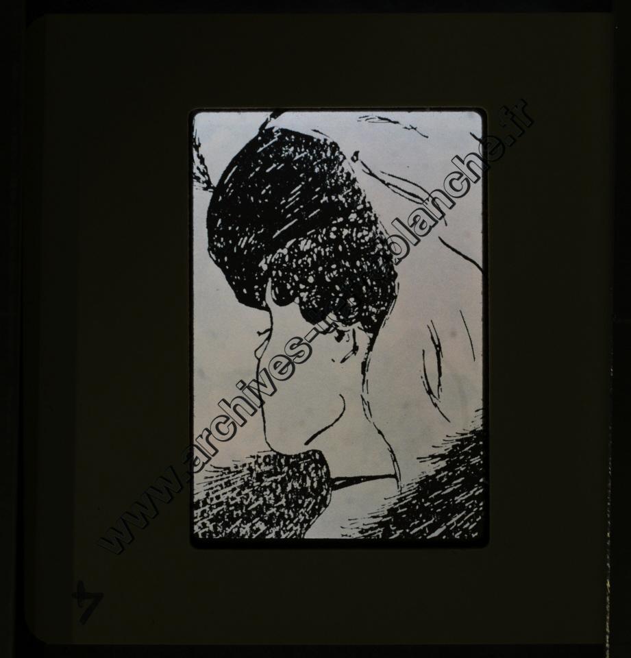 La Protection de la vue