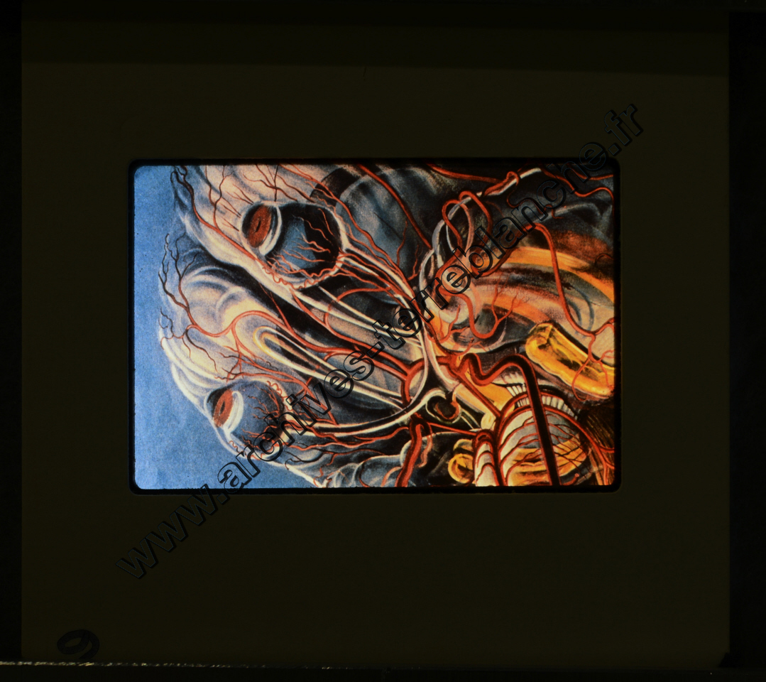 La Protection de la vue