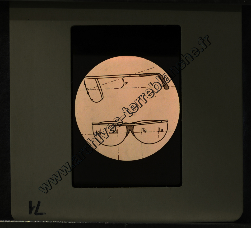 La Protection de la vue