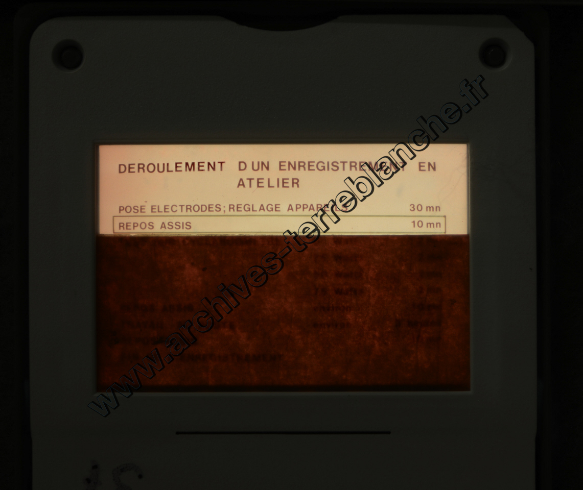 Fréquence Cardiac (partie 2)