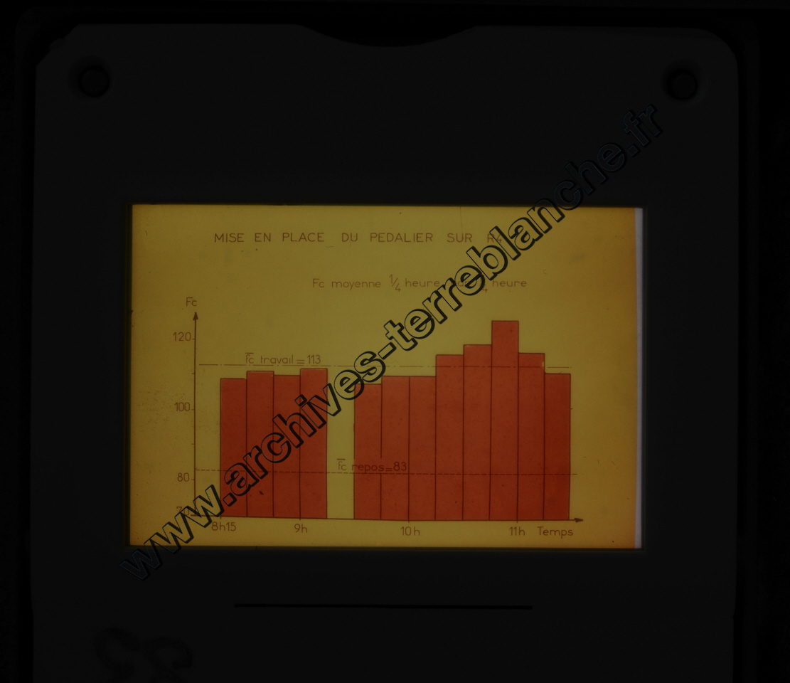 Fréquence Cardiac (partie 2)
