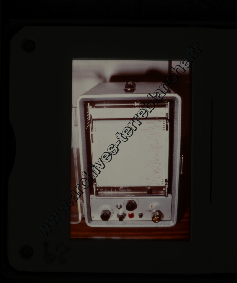 Fréquence Cardiac (partie 2)