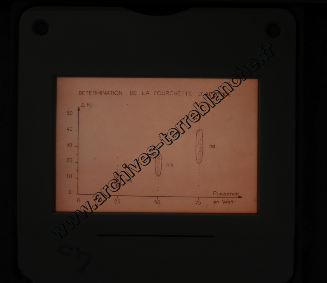 Fréquence Cardiac (partie 1)