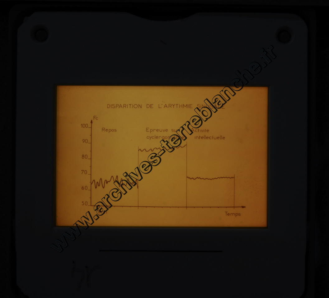 Fréquence Cardiac (partie 1)