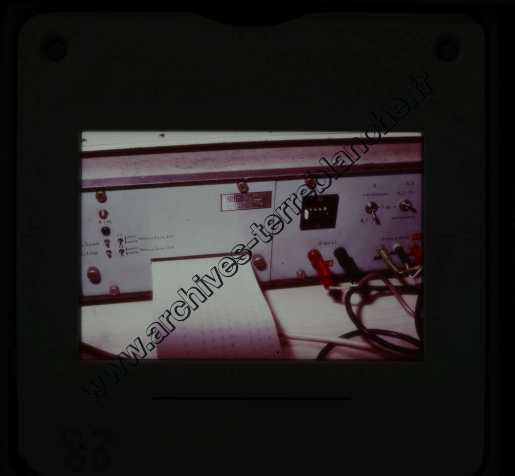 Fréquence Cardiac (partie 1)