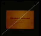 Fréquence Cardiac (partie 2)